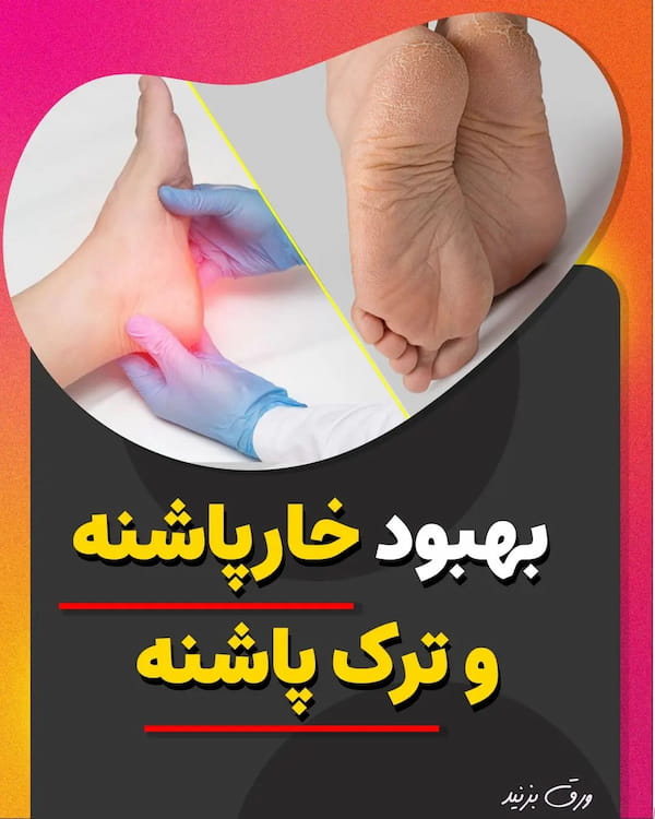 عکس-کفش پاشنه دار جورابی زنانه