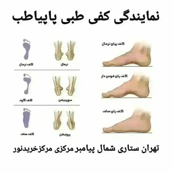 عکس-کفش طبی زنانه