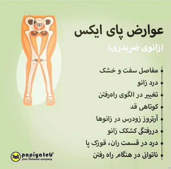 عکس-کفش طبی مردانه