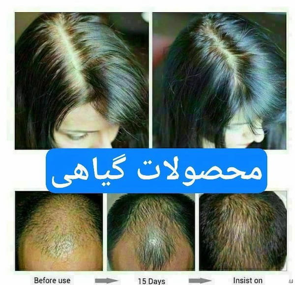 عکس-لباس بارداری زنانه