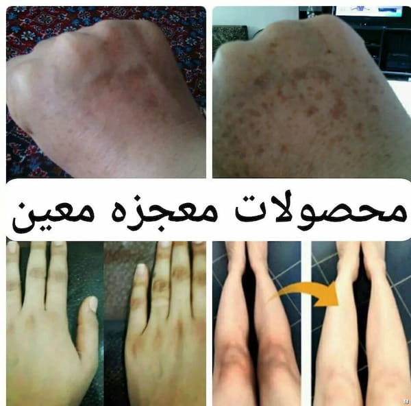 عکس-لباس بارداری زنانه کرمی